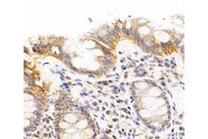 Immunohistochemistry analysis of paraffin-embedded human colon using,CFA (ABIN7076044) at dilution of 1: 300 (TBCA 抗体)