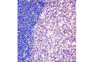 Immunohistochemistry analysis in formalin fixed and paraffin embedded human tonsil tissue reacted with MCM6 Antibody (N-term) followed which was peroxidase conjugated to the secondary antibody and followed by DAB staining. (MCM6 抗体  (N-Term))