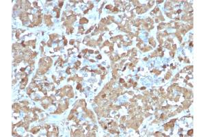 Formalin-fixed, paraffin-embedded human Pituitary stained with Growth Hormone Recombinant Mouse Monoclonal Antibody (rGH/1450). (Recombinant Growth Hormone 1 抗体  (AA 58-187))