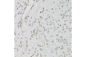 Immunohistochemistry of paraffin-embedded human leiomyoma of uterus using RUVBL1 Antibody. (RUVBL1 抗体  (AA 1-240))