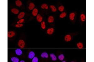 Immunofluorescence (IF) image for anti-DNA (Cytosine-5)-Methyltransferase 1 (DNMT1) antibody (ABIN7259344)