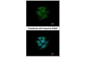 ICC/IF Image Immunofluorescence analysis of methanol-fixed MCF-7, using JNK2, antibody at 1:200 dilution. (JNK2 抗体)