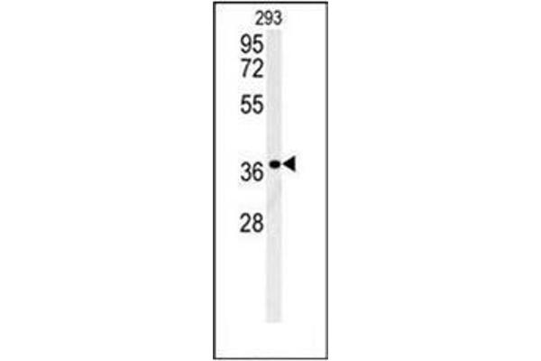 LGALS9B 抗体  (Middle Region)