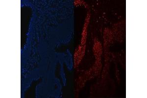 IF analysis of STAG2 using anti-STAG2 antibody (ABIN7602420).