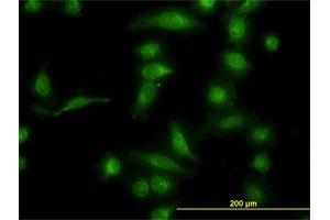 Immunofluorescence of monoclonal antibody to AKR1B10 on HeLa cell.