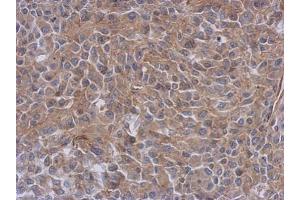 IHC-P Image Immunohistochemical analysis of paraffin-embedded RT2 xenograft, using Radixin, antibody at 1:500 dilution. (Radixin 抗体)