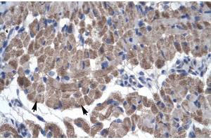 Rabbit Anti-GAS7 Antibody Catalog Number: ARP30004 Paraffin Embedded Tissue: Human Muscle Cellular Data: Skeletal muscle cells Antibody Concentration: 4. (GAS7 抗体  (N-Term))