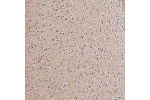 IHC analysis of Septin 11/SEPTIN11 using anti-Septin 11/SEPTIN11 antibody (ABIN7602925). (Septin 11 抗体  (C-Term))