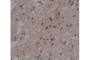 Used in DAB staining on fromalin fixed paraffin- embedded Kidney tissue (ARNT2 抗体  (AA 1-209))
