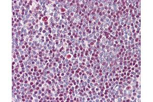 Anti-IKZF3 / AIOLOS antibody IHC of human tonsil. (IKZF3 抗体  (N-Term))