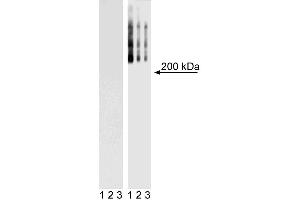 Western Blot analysis of TRA-1-60 in mouse and human ES cell lines.