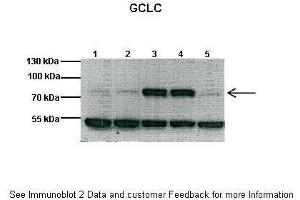 Western Blotting (WB) image for anti-Glutamate-Cysteine Ligase, Catalytic Subunit (GCLC) (N-Term) antibody (ABIN2774078)