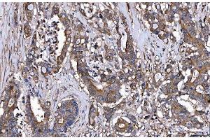 IHC analysis of HGS using anti-HGS antibody (ABIN7601206).