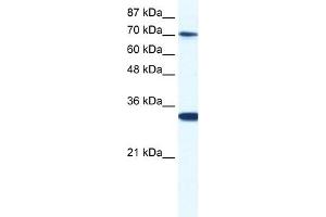 WB Suggested Anti-CNOT3 Antibody Titration:  0. (CNOT3 抗体  (N-Term))
