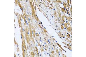 Immunohistochemistry of paraffin-embedded rat heart using GOLM1 antibody (ABIN5974385) at dilution of 1/100 (40x lens). (GOLM1 抗体)