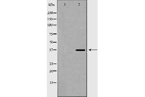 Western blot analysis of extracts of MCF-7, using TOR1A antibody. (TOR1A 抗体  (Internal Region))