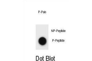 Dot blot analysis of mouse CCNB3 Antibody (Phospho ) Phospho-specific Pab (ABIN1881166 and ABIN2839920) on nitrocellulose membrane. (Cyclin B3 抗体  (pThr257))