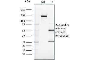 SDS-PAGE Analysis Purified ZNF690 / ZSCAN29 Mouse Monoclonal Antibody (ZSCAN29/2610). (ZSCAN29 抗体)