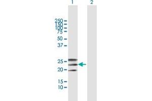 Western Blot analysis of EFNA2 expression in transfected 293T cell line by EFNA2 MaxPab polyclonal antibody. (Ephrin A2 抗体  (AA 1-213))