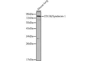 Western blot analysis of extracts of Mouse lung cells, using CD138/Syndecan-1 antibody (ABIN3021804, ABIN3021805, ABIN3021806 and ABIN6215950) at 1:1000 dilution. (Syndecan 1 抗体  (AA 25-240))