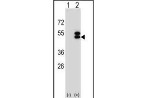 Western blot analysis of ATXN3 (arrow) using rabbit polyclonal ATXN3 Antibody (Center) (ABIN653191 and ABIN2842741). (Ataxin 3 抗体  (AA 261-288))