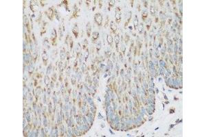 Immunohistochemistry of paraffin-embedded Human esophagus using IGF2BP3 Polyclonal Antibody at dilution of 1:200 (40x lens). (IGF2BP3 抗体)