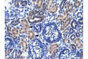 Image no. 3 for anti-Ring Finger Protein 141 (RNF141) (AA 96-145) antibody (ABIN6735889) (RNF141 抗体  (AA 96-145))