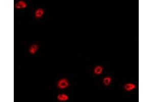 Immunofluorescence (fixed cells) (IF/ICC) image for anti-Tumor Protein P53 (TP53) (pSer15) antibody (ABIN6256151)