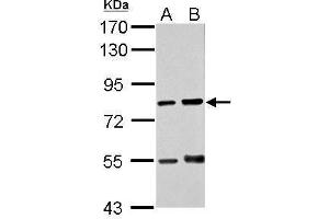 WB Image Sample (30 ug of whole cell lysate) A: THP-1 B: HL-60 7. (Protein Red (IK) (N-Term) 抗体)