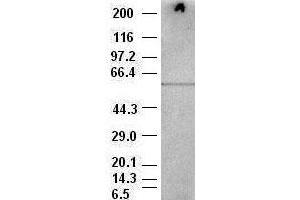 Western Blotting (WB) image for anti-V-Akt Murine Thymoma Viral Oncogene Homolog 3 (Protein Kinase B, Gamma) (AKT3) antibody (ABIN2715859)