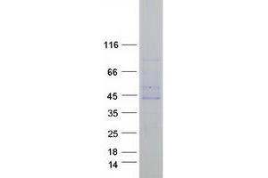 Western Blotting (WB) image for Family with Sequence Similarity 46, Member C (FAM46C) protein (Myc-DYKDDDDK Tag) (ABIN2720789)
