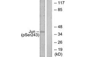 Western blot analysis of extracts from HeLa cells treated with UV, using c-Jun (Phospho-Ser243) Antibody. (C-JUN 抗体  (pSer243))