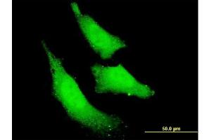 Immunofluorescence of monoclonal antibody to RNF111 on HeLa cell. (RNF111 抗体  (AA 1-108))