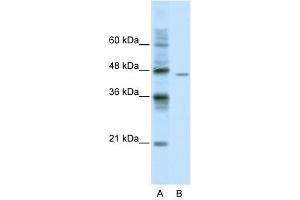 DDX25 antibody used at 0. (DDX25 抗体)