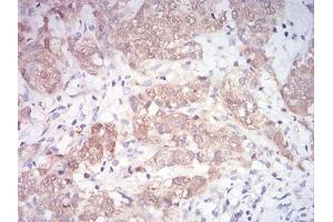 Immunohistochemistry (IHC) image for anti-Mitogen-Activated Protein Kinase Kinase 3 (MAP2K3) (AA 1-138) antibody (ABIN5542528)