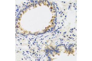 Immunohistochemistry of paraffin-embedded rat lung using UVRAG antibody. (UVRAG 抗体  (AA 501-699))