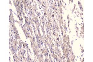 IHC analysis of KCNA1 using anti-KCNA1 antibody (ABIN6719578).