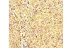 Immunohistochemistry of paraffin-embedded human adrenal gland tissue using ABIN7161000 at dilution of 1:100 (ME3 抗体  (AA 547-598))