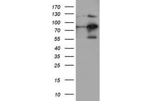 Western Blotting (WB) image for anti-Folate Hydrolase (Prostate-Specific Membrane Antigen) 1 (FOLH1) antibody (ABIN1500454) (PSMA 抗体)