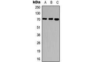 Western blot analysis of Ubiquilin 3 expression in HepG2 (A), rat brain (B), rat liver (C) whole cell lysates. (Ubiquilin 3 抗体  (Center))