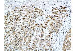 Formalin-fixed and paraffin embedded rat liver labeled with Anti-HBsAg(H2F4) Monoclonal Antibody, Unconjugated (bsm-2024M) at 1:200 followed by conjugation to the secondary antibody and DAB staining (HBSAg 抗体)