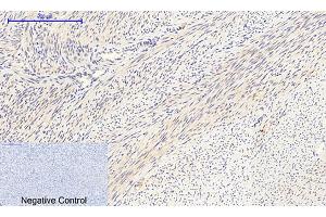 Immunohistochemical analysis of paraffin-embedded human uterus tissue.