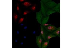ABIN6263551 and ABIN6266920 staining  cells by IF/ICC.