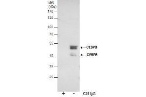 IP Image Immunoprecipitation of CEBPB protein from HeLa nuclear extracts using 5 μg of C/EBP beta antibody, Western blot analysis was performed using C/EBP beta antibody, EasyBlot anti-Rabbit IgG  was used as a secondary reagent. (CEBPB 抗体  (N-Term))