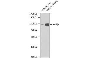 Western blot analysis of extracts of various cell lines, using H6PD Antibody (ABIN6131015, ABIN6141581, ABIN6141582 and ABIN6222086) at 1:1000 dilution. (Glucose-6-Phosphate Dehydrogenase 抗体  (AA 20-200))