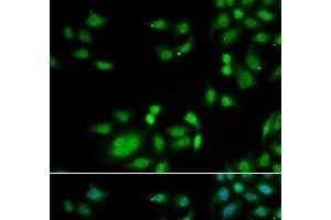 Immunofluorescence analysis of A549 cells using INTS10 Polyclonal Antibody (INTS10 抗体)