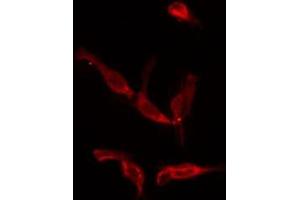 ABIN6275927 staining COLO205 by IF/ICC. (CysLTR1 抗体  (Internal Region))