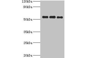 Western blot All lanes: PDHX antibody at 6 μg/mL Lane 1: 293T whole cell lysate Lane 2: PC-3 whole cell lysate Lane 3: MCF-7 whole cell lysate Secondary Goat polyclonal to rabbit IgG at 1/10000 dilution Predicted band size: 55, 30, 52 kDa Observed band size: 55 kDa (PDHX 抗体  (AA 1-300))
