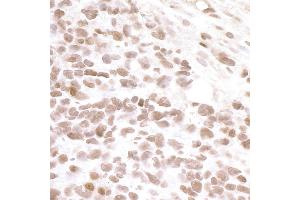 Immunohistochemistry (IHC) image for anti-Bromodomain Containing 4 (BRD4) (AA 1312-1362) antibody (ABIN7448442) (BRD4 抗体  (AA 1312-1362))