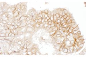 Immunohistochemistry (IHC) image for anti-Basigin (Ok Blood Group) (BSG) (AA 200-250) antibody (ABIN7454582)
